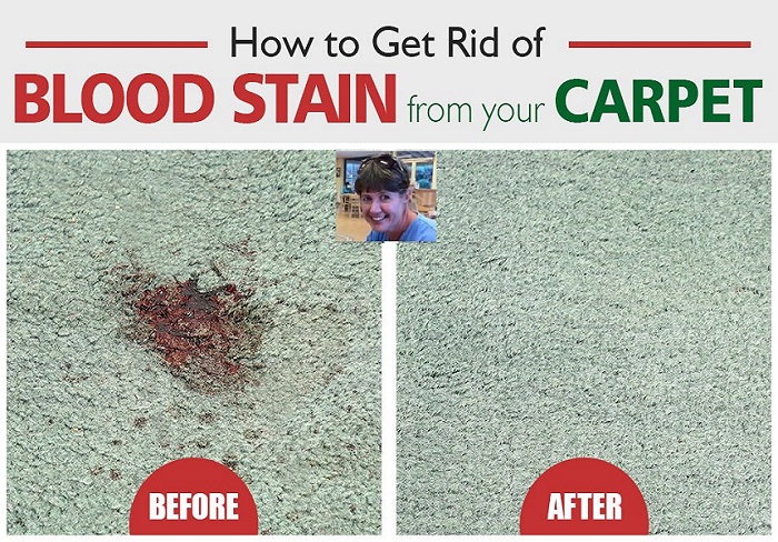 How to Get Blood Out of a Carpet